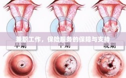 兼职工作的保险服务保障与支持