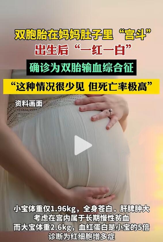 双胞胎子宫内斗争，一红一白生死边缘，医生成功抢救转危为安-图2