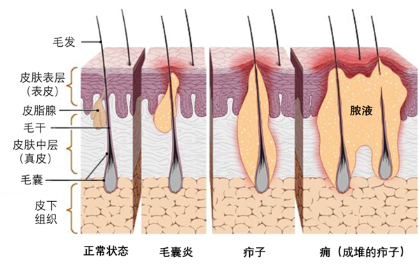 红包陷阱,危险隐患重重,硬挤代价惨重-图2 红包陷阱,危险隐患重重,硬挤代价惨重-图2