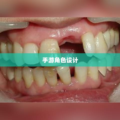 手游中为何缺乏大嘴角色?探究其原因及影响-图1 手游中为何缺乏大嘴角色?探究其原因及影响-图1