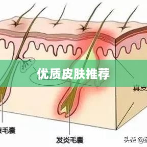 LOL手游换肤攻略，优质皮肤推荐，助你游戏更畅快体验-图1