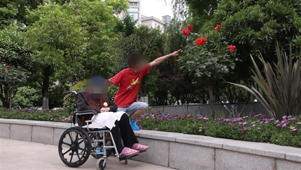 亚洲首例异种肾移植患者成功打破生存期魔咒,术后生存超60天记录创奇迹-图2 亚洲首例异种肾移植患者成功打破生存期魔咒,术后生存超60天记录创奇迹-图2