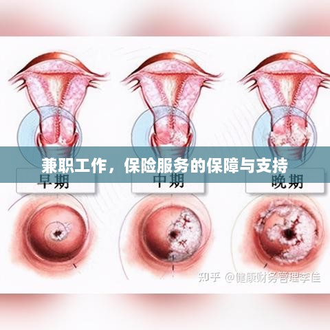 兼职工作的保险服务保障与支持-图1