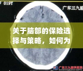 如何选择合适的脑部保险，为您的大脑保驾护航？-图1