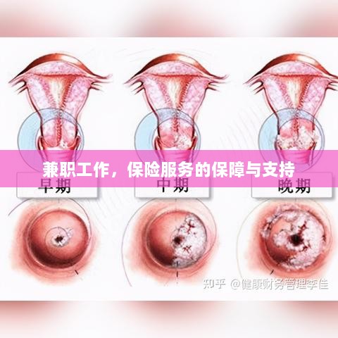 兼职工作的保险服务保障与支持-图1 兼职工作的保险服务保障与支持-图1