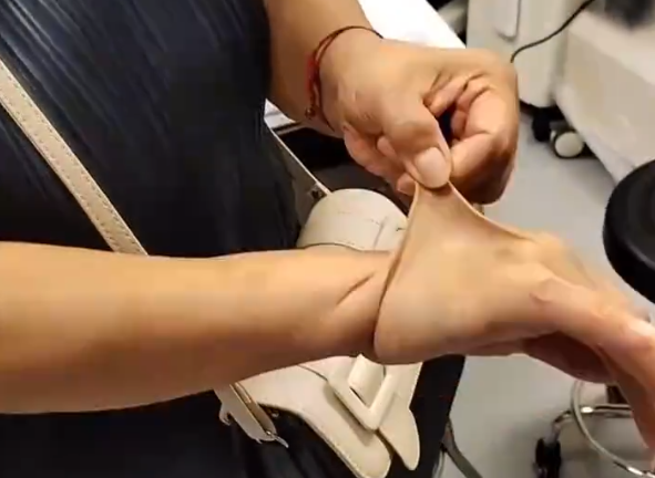 女子患罕见病,皮肤可拉伸如橡皮人,胞姐成为首例确诊者-图2 女子患罕见病,皮肤可拉伸如橡皮人,胞姐成为首例确诊者-图2