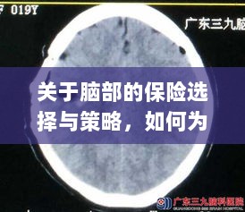 如何选择合适的脑部保险,为您的大脑保驾护航?-图1 如何选择合适的脑部保险,为您的大脑保驾护航?-图1