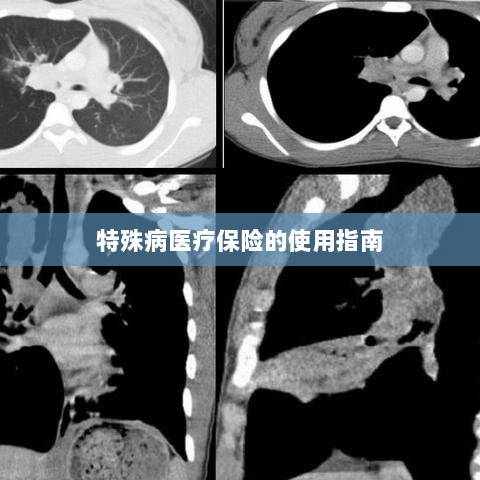 特殊病医疗保险使用指南详解-图1 特殊病医疗保险使用指南详解-图1