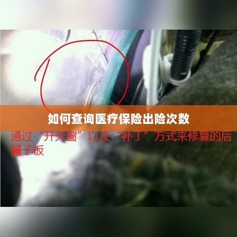 医疗保险出险次数查询攻略-图1 医疗保险出险次数查询攻略-图1