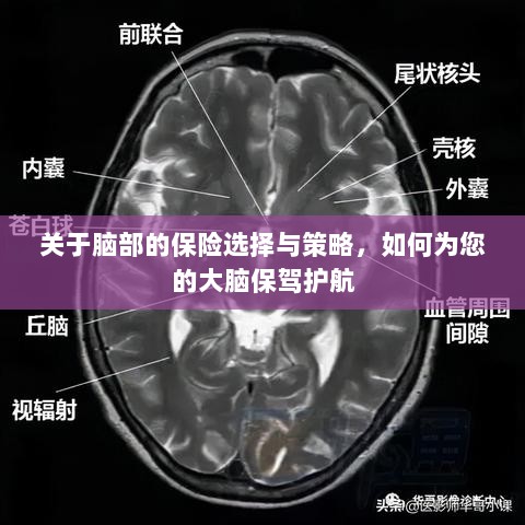 如何为大脑保驾护航，选择最佳脑部保险策略与方案-图1