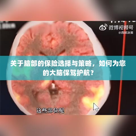 如何选择合适的脑部保险,为您的大脑保驾护航?-图1 如何选择合适的脑部保险,为您的大脑保驾护航?-图1