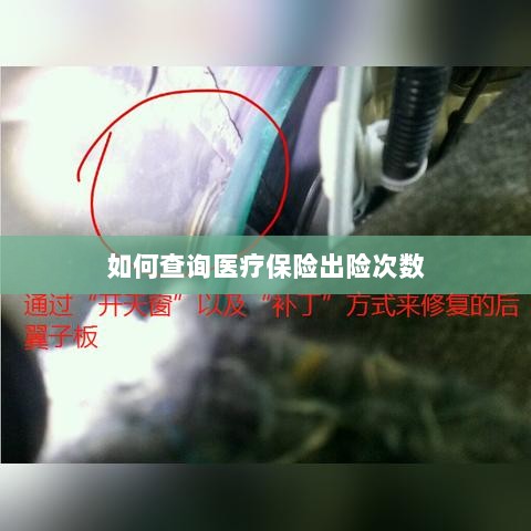 医疗保险出险次数查询攻略-图1 医疗保险出险次数查询攻略-图1