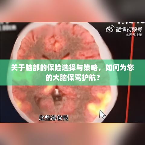 如何选择合适的脑部保险,为您的大脑保驾护航?-图1 如何选择合适的脑部保险,为您的大脑保驾护航?-图1