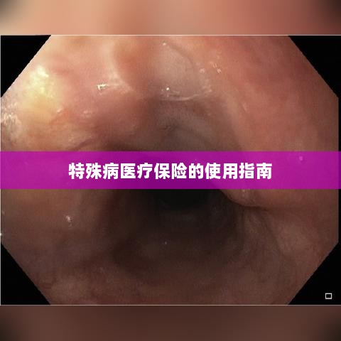 特殊病医疗保险使用指南详解-图1 特殊病医疗保险使用指南详解-图1