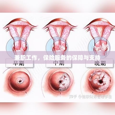 兼职工作的保险服务保障与支持-图1